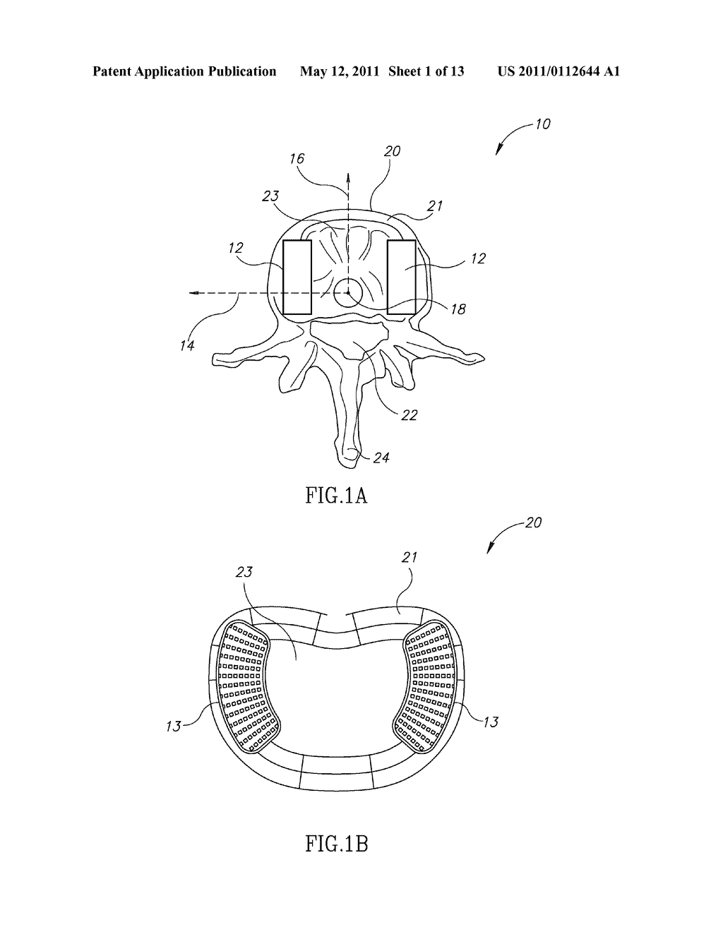 DISC PROSTHETIC IMPLANT DEVICE - diagram, schematic, and image 02