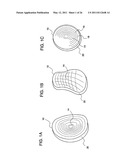 METHODS FOR LESS INVASIVE GLENOID REPLACEMENT diagram and image