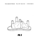 METHODS FOR LESS INVASIVE GLENOID REPLACEMENT diagram and image