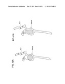 METHODS FOR LESS INVASIVE GLENOID REPLACEMENT diagram and image