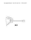 METHODS FOR LESS INVASIVE GLENOID REPLACEMENT diagram and image