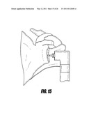 METHODS FOR LESS INVASIVE GLENOID REPLACEMENT diagram and image