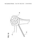 METHODS FOR LESS INVASIVE GLENOID REPLACEMENT diagram and image