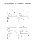 METHODS FOR LESS INVASIVE GLENOID REPLACEMENT diagram and image