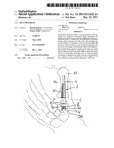 JOINT PROSTHESIS diagram and image