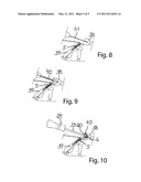 JOINT PROSTHESIS diagram and image