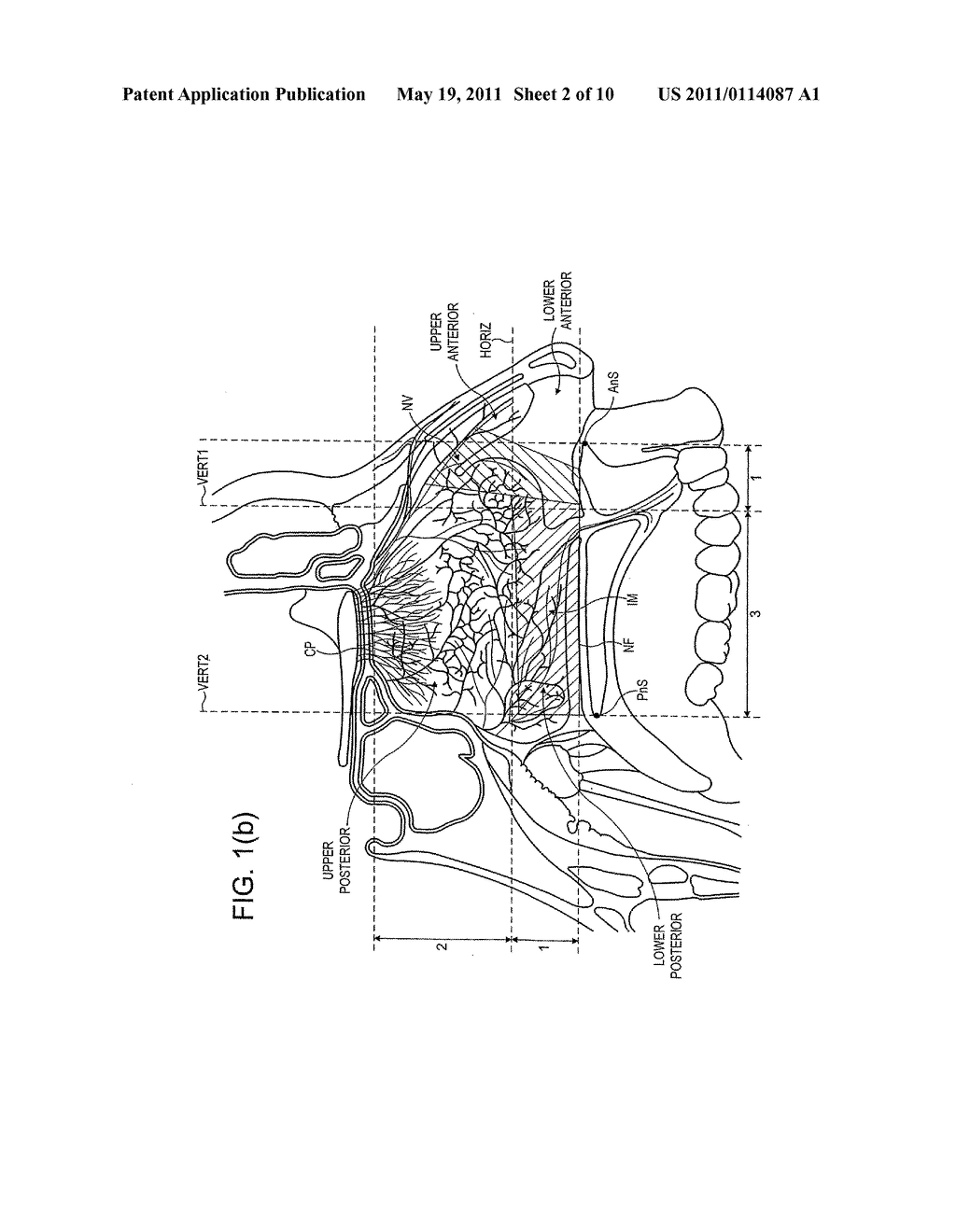 NASAL ADMINISTRATION - diagram, schematic, and image 03