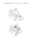 NASAL ADMINISTRATION diagram and image