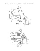 NASAL ADMINISTRATION diagram and image