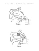 NASAL ADMINISTRATION diagram and image