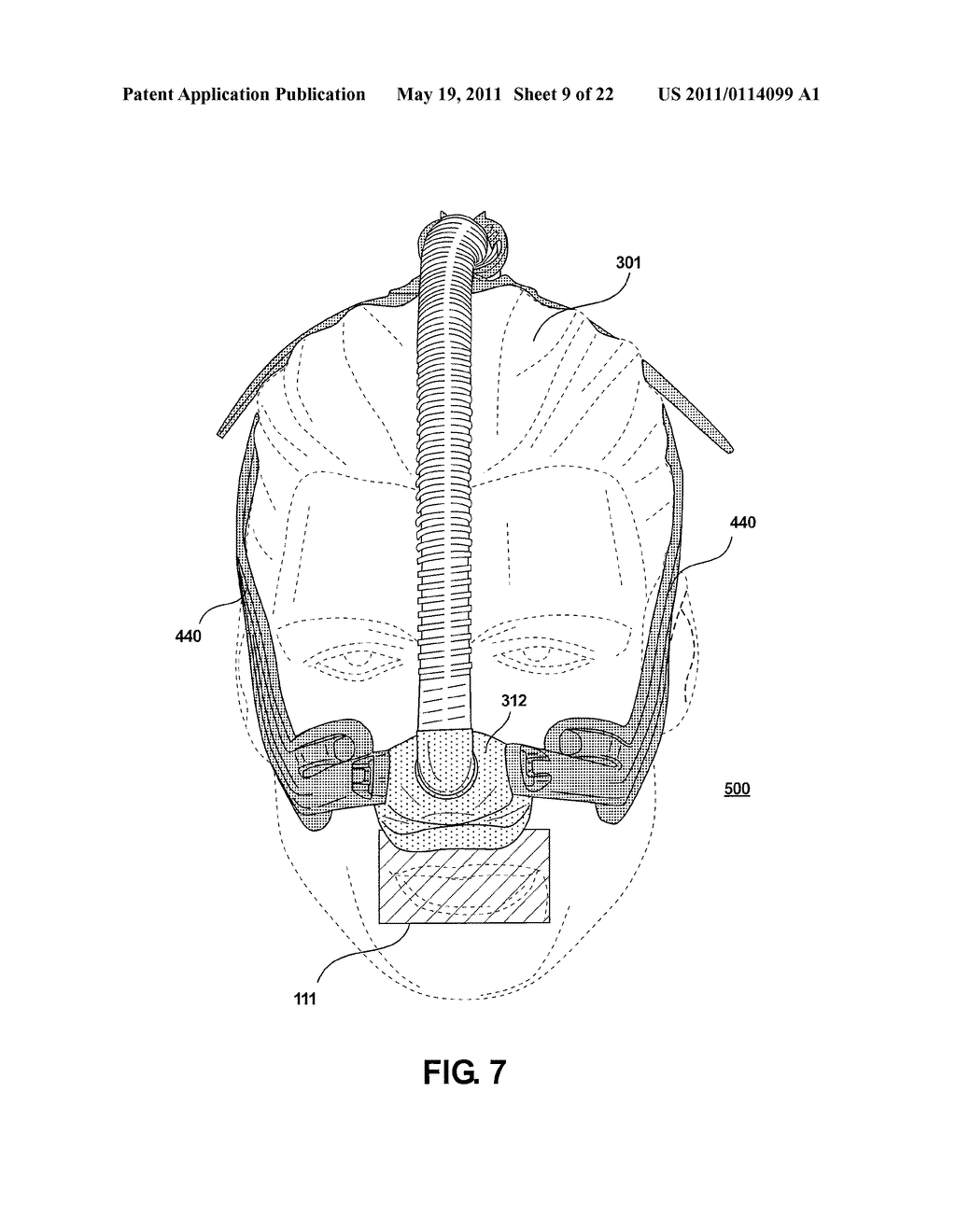 RESPIRATORY SHIELD - diagram, schematic, and image 10