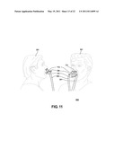 RESPIRATORY SHIELD diagram and image