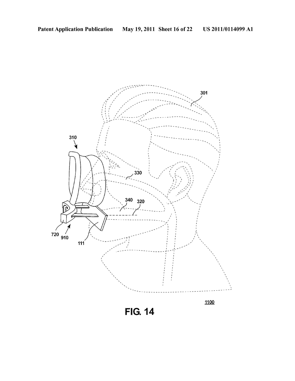 RESPIRATORY SHIELD - diagram, schematic, and image 17