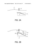 REDUCING MOTION ARTEFACTS IN MRI diagram and image