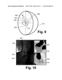 VIRTUAL ENDOSCOPY diagram and image