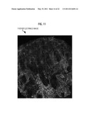 RAPID CONFOCAL MICROSCOPY TO SUPPORT SURGICAL PROCEDURES diagram and image