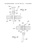 FASTENER FOR LENSES diagram and image