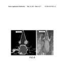 RADIOLABELED GALLIUM COMPLEXES, METHODS FOR SYNTHESIS AND USE FOR PET IMAGING OF EGFR EXPRESSION IN MALIGNANT TUMORS diagram and image