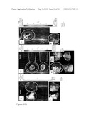 DEVICE AND METHOD FOR FLUORESCENCE-BASED IMAGING AND MONITORING diagram and image