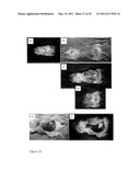 DEVICE AND METHOD FOR FLUORESCENCE-BASED IMAGING AND MONITORING diagram and image