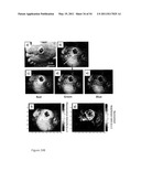 DEVICE AND METHOD FOR FLUORESCENCE-BASED IMAGING AND MONITORING diagram and image