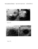 DEVICE AND METHOD FOR FLUORESCENCE-BASED IMAGING AND MONITORING diagram and image