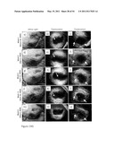 DEVICE AND METHOD FOR FLUORESCENCE-BASED IMAGING AND MONITORING diagram and image