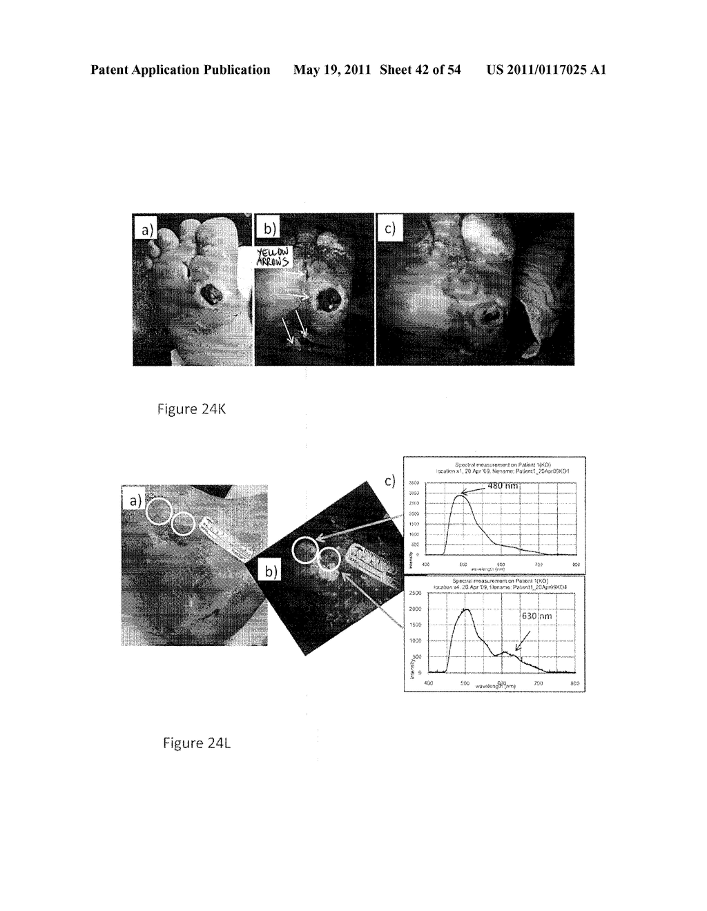 DEVICE AND METHOD FOR FLUORESCENCE-BASED IMAGING AND MONITORING - diagram, schematic, and image 43