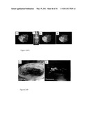 DEVICE AND METHOD FOR FLUORESCENCE-BASED IMAGING AND MONITORING diagram and image