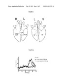 Vaccine Against Highly Pathogenic Porcine Reproductive and Respiratory Syndrome (HP PRRS) diagram and image