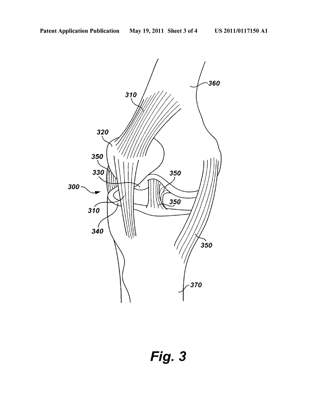 Device, system, and method for targeted delivery of anti-inflammatory medicaments to a mammalian subject - diagram, schematic, and image 04