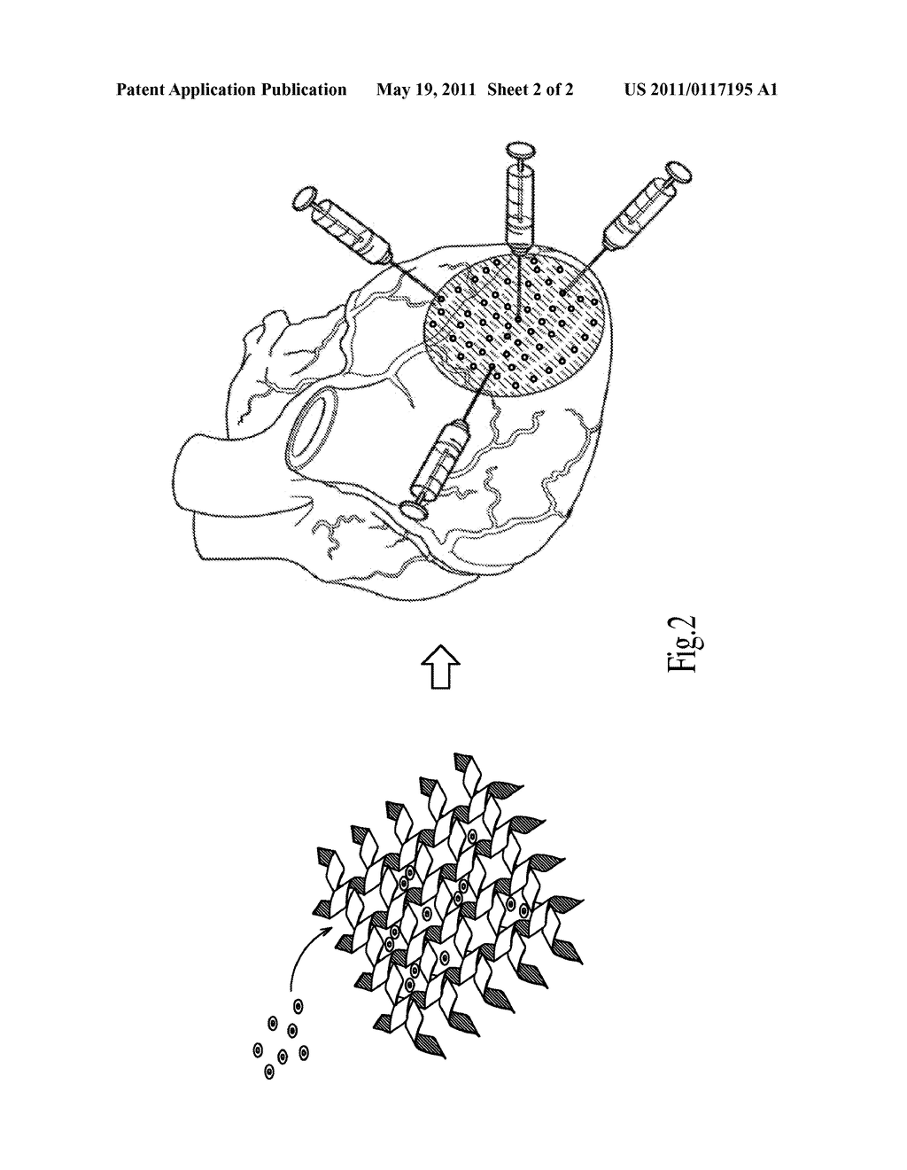 METHOD FOR IMPROVING MYOCARDIAL INFARCTION BY INTRAMYOCARDIAL OR TRANSENDOCARDIAL INJECTION OF PEPTIDE NANOFIBERS - diagram, schematic, and image 03