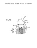 SURGICAL GUIDE, AND A METHOD FOR POSITIONING A DRILL USING THE SURGICAL GUIDE diagram and image