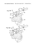 SURGICAL GUIDE, AND A METHOD FOR POSITIONING A DRILL USING THE SURGICAL GUIDE diagram and image