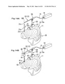 SURGICAL GUIDE, AND A METHOD FOR POSITIONING A DRILL USING THE SURGICAL GUIDE diagram and image