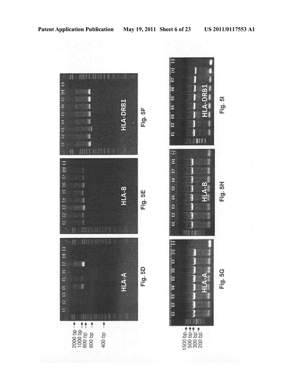 Methods for PCR and HLA typing using raw blood - diagram, schematic, and image 07