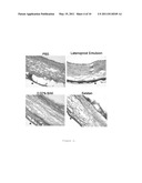 USE OF PROSTAGLANDINS F2ALPHA AND ANALOGUES FOR THE HEALING OF CORNEAL AND CONJUNCTIVAL LESIONS diagram and image