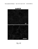 Methods and Nutritional Formulations to Increase the Efficacy and Reduce the Side Effects of Cancer Treatment diagram and image