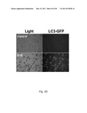 Methods and Nutritional Formulations to Increase the Efficacy and Reduce the Side Effects of Cancer Treatment diagram and image