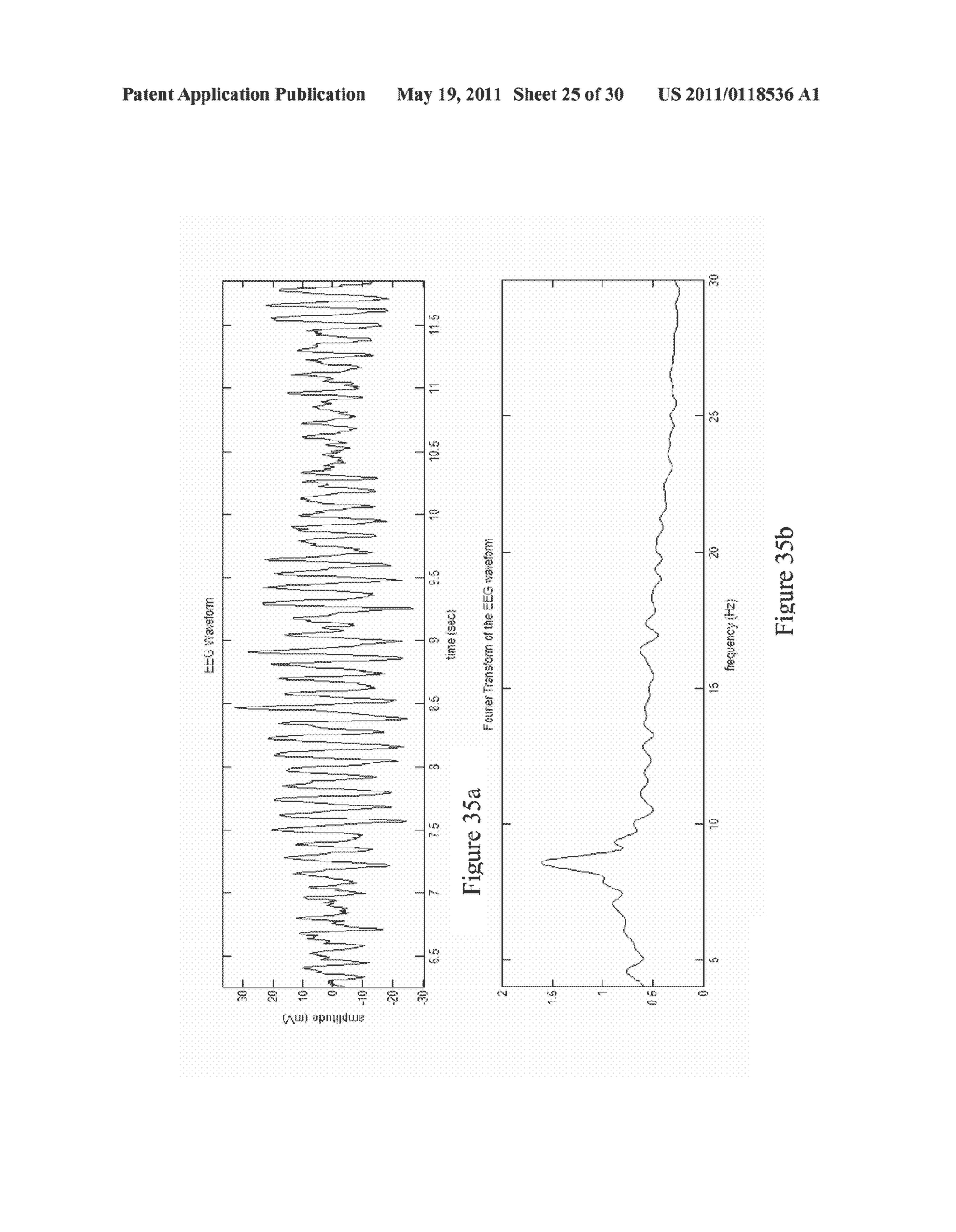 SYSTEMS AND METHODS FOR NEURO-EEG SYNCHRONIZATION THERAPY - diagram, schematic, and image 26