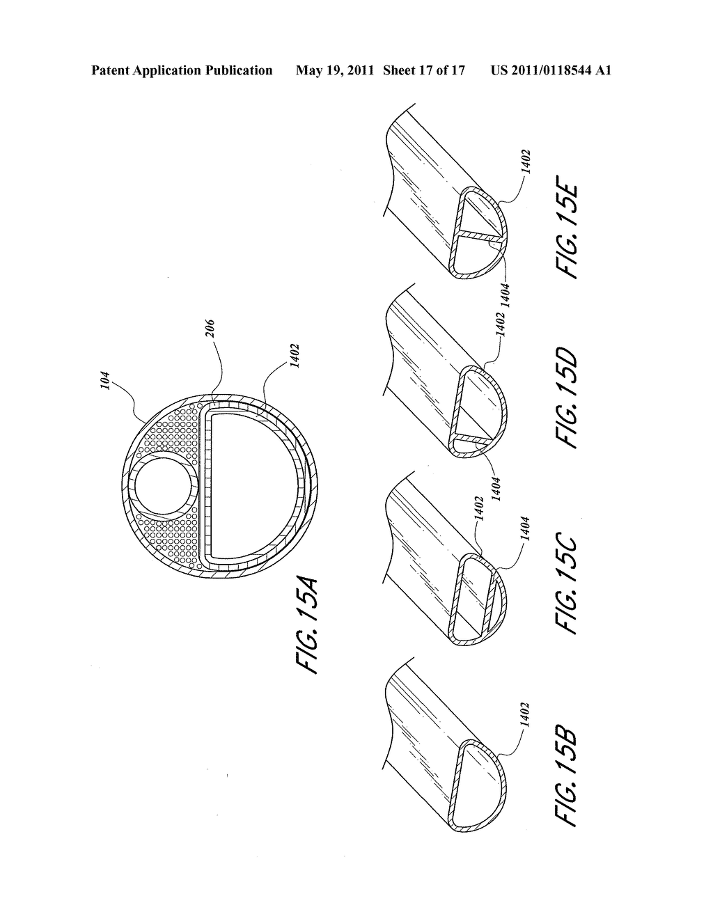 ACCESS SYSTEM WITH REMOVABLE OUTFLOW CHANNEL - diagram, schematic, and image 18