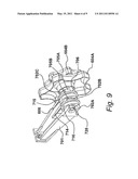 ENDOSCOPE diagram and image