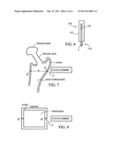 Method for Detecting Body Parameters diagram and image