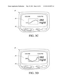 SYSTEMS AND METHODS FOR REPLACING SIGNAL ARTIFACTS IN A GLUCOSE SENSOR DATA STREAM diagram and image