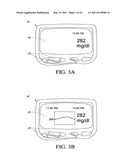 SYSTEMS AND METHODS FOR REPLACING SIGNAL ARTIFACTS IN A GLUCOSE SENSOR DATA STREAM diagram and image