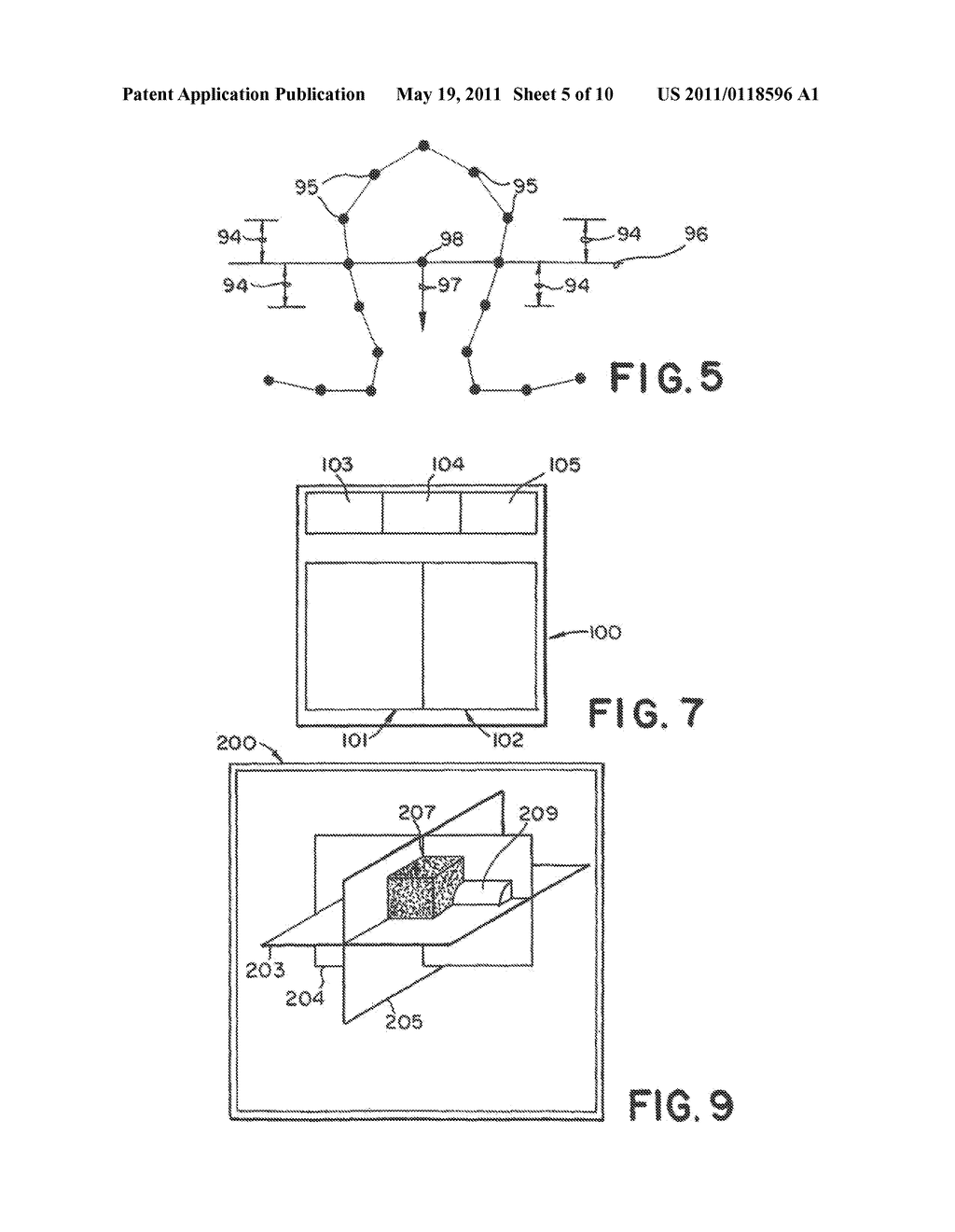 AUTOMATIC ANALYSIS IN VIRTUAL ENDOSCOPY - diagram, schematic, and image 06