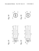 Ultrasound Guided Systems and Methods diagram and image