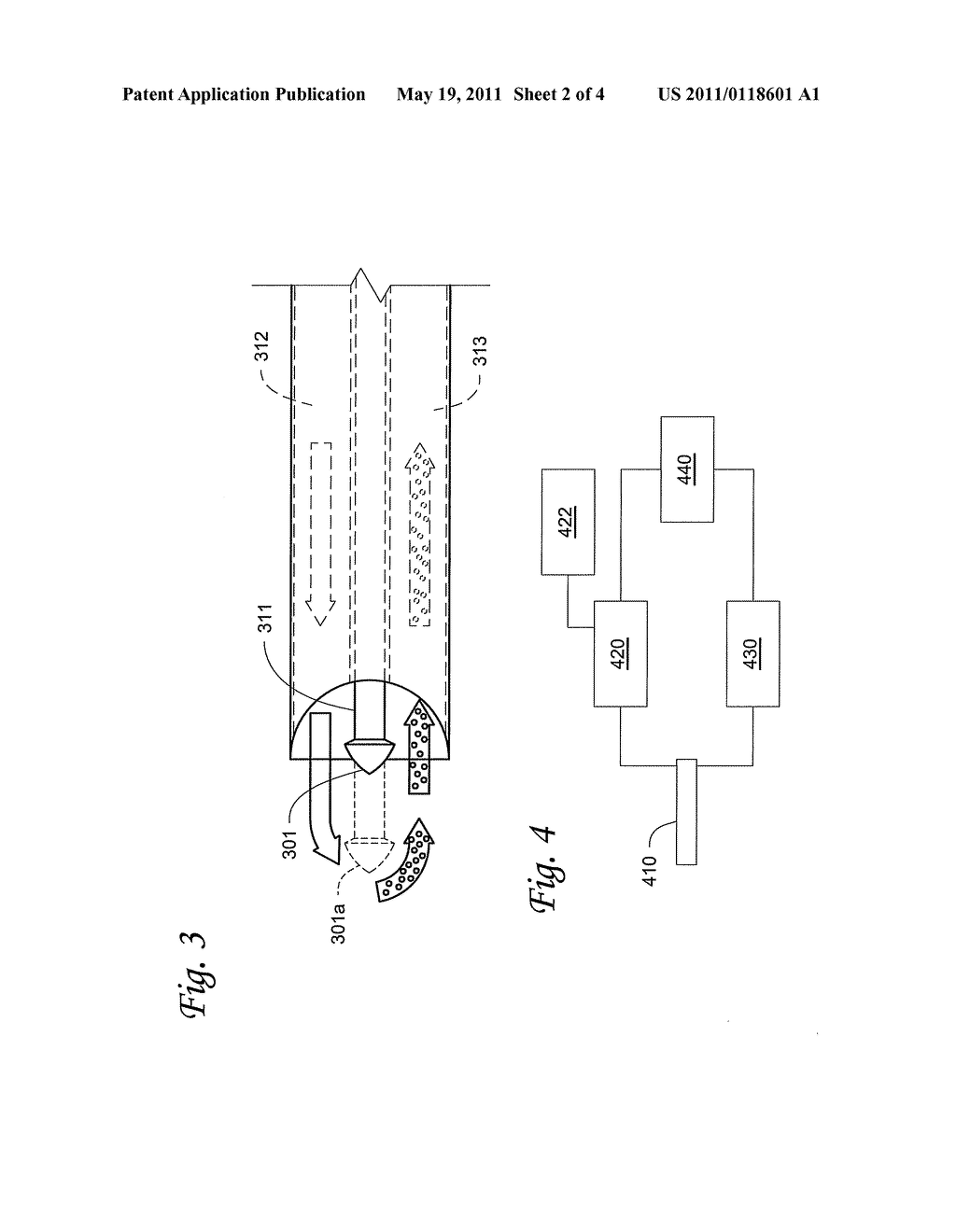 Ultrasound Guided Systems and Methods - diagram, schematic, and image 03