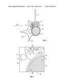 Spinous Navigation System and Associated Methods diagram and image