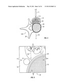 Spinous Navigation System and Associated Methods diagram and image